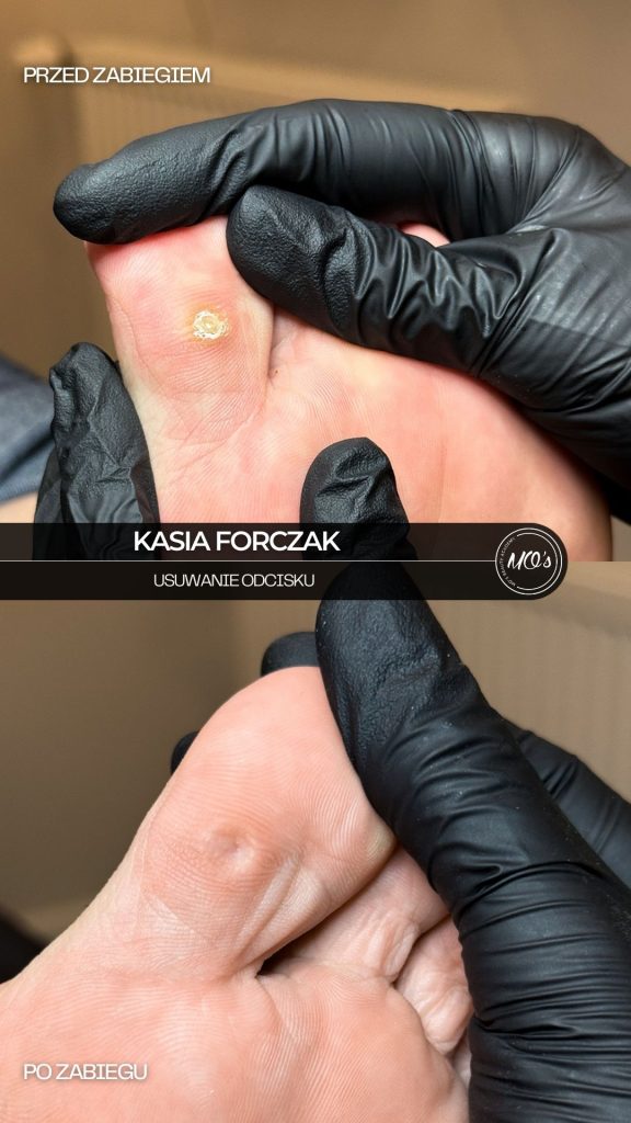 Dobry Podolog Warszawa, gabinet podologiczny, lekarz od paznokci